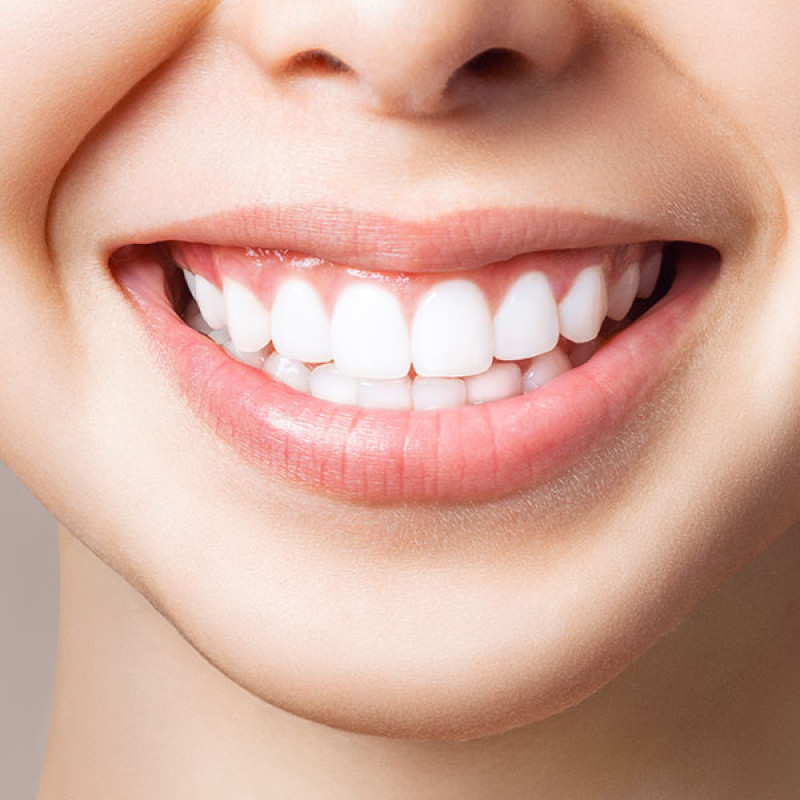 Scalling & Polishing